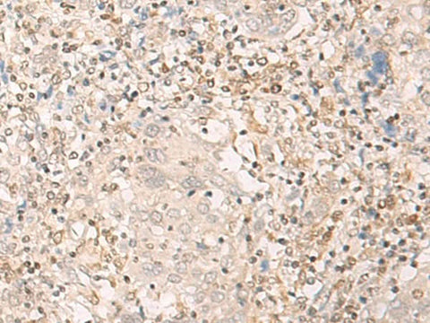 Anti-Human EPSTI1 Antibody - ABMIUM