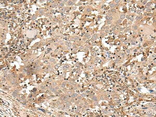Anti-Human/Mouse FSTL5 Antibody