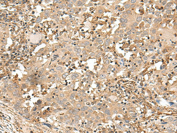 Anti-Human/Mouse FSTL5 Antibody - ABMIUM
