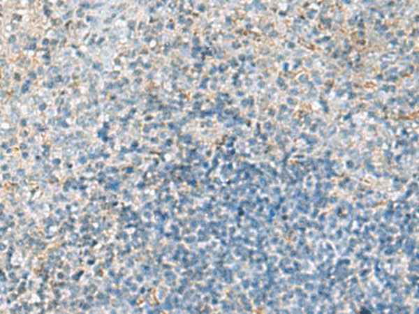 Anti-Human/Mouse EMILIN1 Antibody