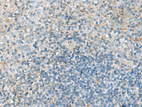 Immunohistochemistry of paraffin-embedded Human tonsil tissue using EMILIN1 Polyclonal Antibody at dilution of 1:70(×200)