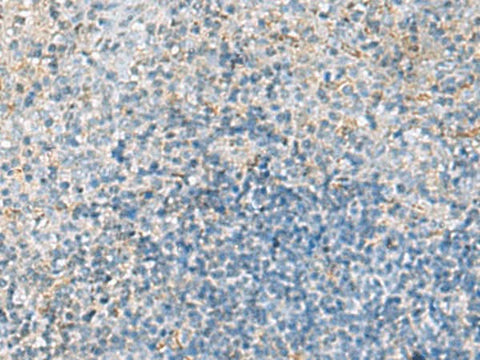 Immunohistochemistry of paraffin-embedded Human tonsil tissue using EMILIN1 Polyclonal Antibody at dilution of 1:70(×200)