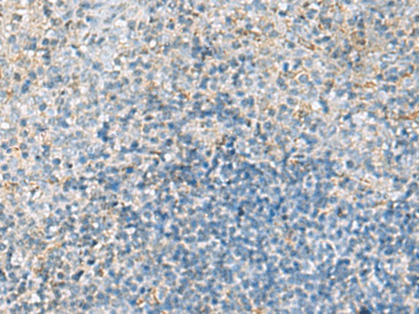 Immunohistochemistry of paraffin-embedded Human tonsil tissue using EMILIN1 Polyclonal Antibody at dilution of 1:70(×200)
