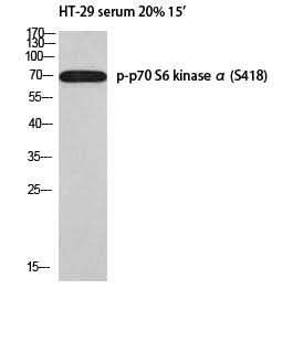 Western Blot analysis of HT-29 serum 20% 15' cells using Phospho-p70 S6 kinase alpha (Ser418) Polyclonal Antibody at dilution of 1:1000