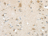 Anti-Human VSIG10 Antibody - ABMIUM