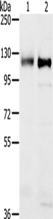 Anti-Human/Mouse PTPN12 Antibody - ABMIUM
