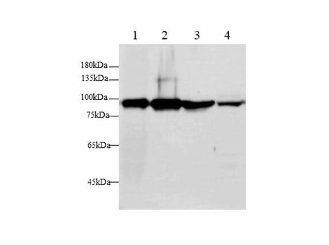 Western blot with GS Polyclonal antibody at dilution of 1:500.lane 1:Human Plasma, lane 2:THP-1 whole cell lysate, lane 3:MCF-7 whole cell lysate,lane 4:A431 whole cell lysate