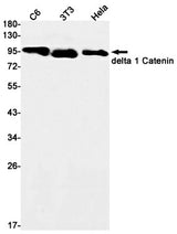 Western blot detection of delta 1 Catenin in C6,3T3,Hela cell lysates using delta 1 Catenin Rabbit mAb(1:1000 diluted).Predicted band size:108kDa.Observed band size:108kDa.