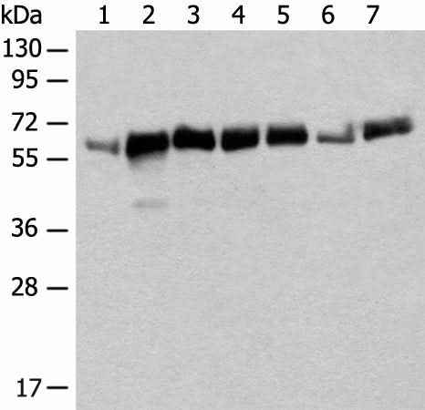 Anti-Human/Mouse/Rat CCDC47 Antibody