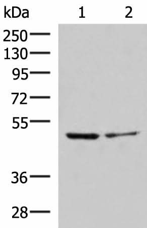 Western blot analysis of Jurkat and HepG2 cell lysates using ECSIT Polyclonal Antibody at dilution of 1:1000