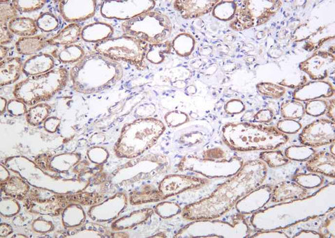 Anti-Human/Mouse/Rat eNOS Antibody [B1007] - ABMIUM