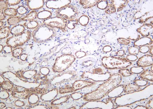 Anti-Human/Mouse/Rat eNOS Antibody [B1007] - ABMIUM