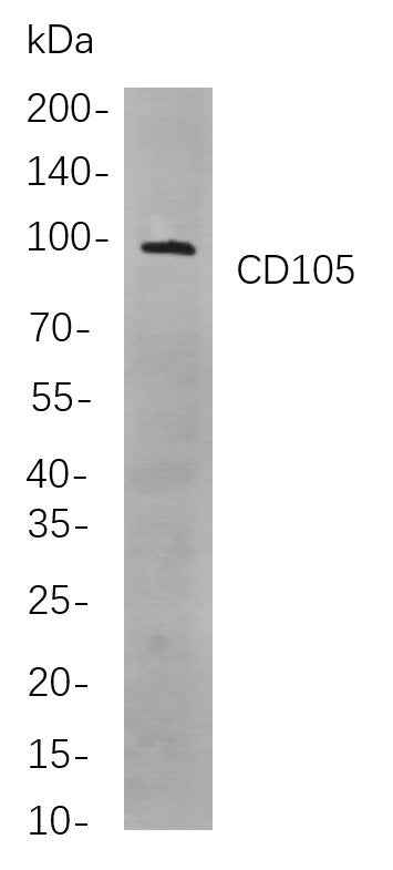 Anti-Human CD105 Antibody [B845] - ABMIUM