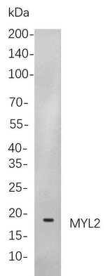 Anti-Human/Mouse/Rat Myosin Light Chain 2 Antibody [B841]