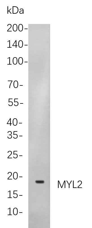 Anti-Human/Mouse/Rat Myosin Light Chain 2 Antibody [B841] - ABMIUM