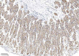 Anti-Human CLDN18 Antibody [A1001] - ABMIUM