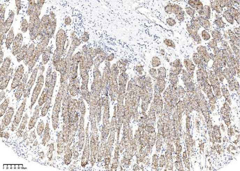 Anti-Human CLDN18 Antibody [A1001] - ABMIUM