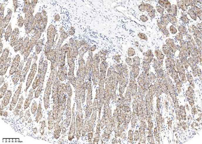 Anti-Human CLDN18 Antibody [A1001] - ABMIUM