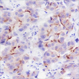 Anti-Human/Rat/Mouse Phospho-Girdin (Tyr1765) Antibody [A794] - ABMIUM