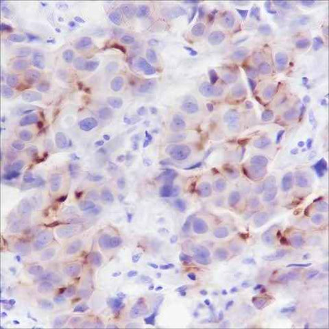 Anti-Human/Rat/Mouse Phospho-Girdin (Tyr1765) Antibody [A794]