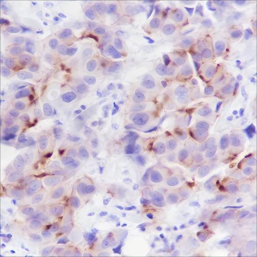Anti-Human/Rat/Mouse Phospho-Girdin (Tyr1765) Antibody [A794] - ABMIUM