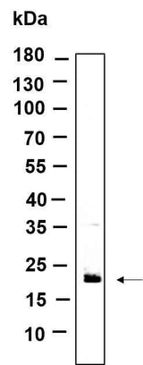 Anti-Human/Mouse RAB7B Antibody [B978]
