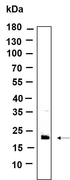 Anti-Human/Mouse RAB7B Antibody [B978]
