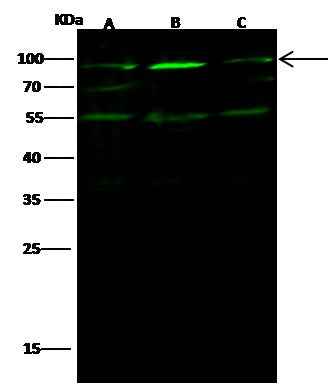 Anti-Human EZR Antibody [A1073] - ABMIUM