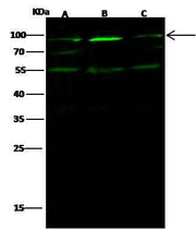 Anti-Human EZR Antibody [A1073] - ABMIUM