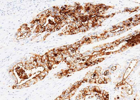 Anti-Human CEACAM5 Antibody [B296] - ABMIUM