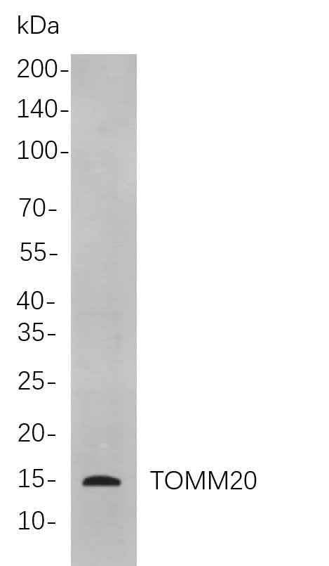 Anti-Human/Mouse/Rat TOMM20 Antibody [B791] - ABMIUM