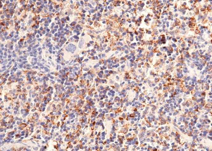 Anti-Mouse CD302 Antibody [A1280] - ABMIUM
