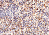 Anti-Mouse CD302 Antibody [A1280] - ABMIUM