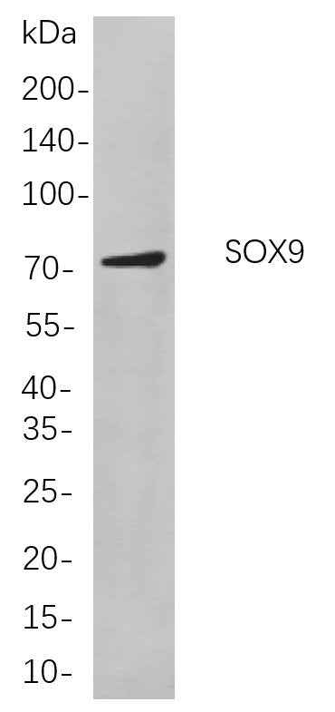 Anti-Human/Mouse/Rat SOX9 Antibody [B793] - ABMIUM