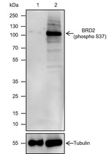 Anti-Human Phospho-BRD2 (S37) Antibody [A809] - ABMIUM