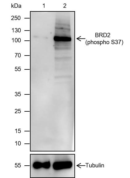 Anti-Human Phospho-BRD2 (S37) Antibody [A809] - ABMIUM