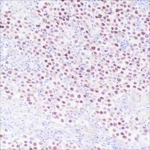 Anti-Human SALL4 Antibody [A354] - ABMIUM