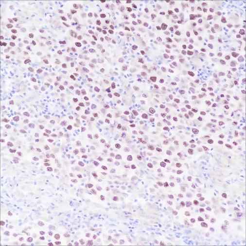 Anti-Human SALL4 Antibody [A354] - ABMIUM