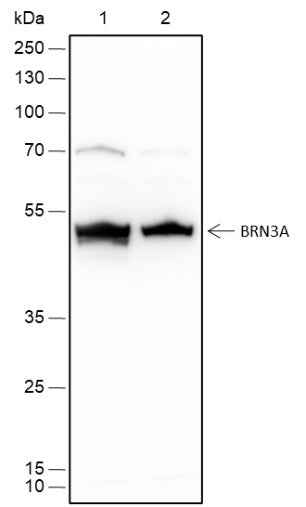 Anti-Human BRN3A Antibody [A457] - ABMIUM