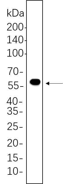 Anti-Human/Mouse/Rat DFNA5 Antibody [B741] - ABMIUM