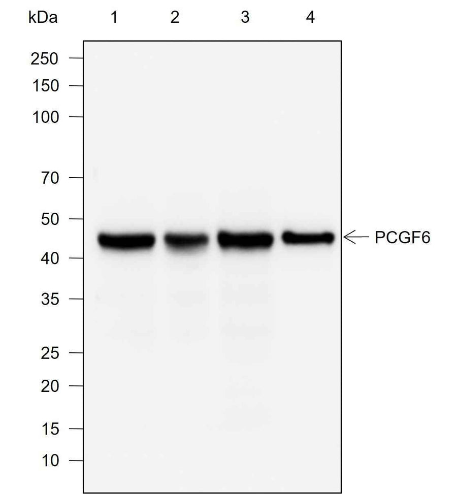 Anti-Rat/Mouse PCGF6 Antibody [A751]