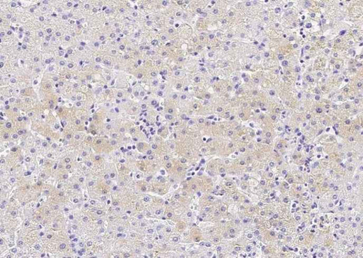 Anti-Human CES3 Antibody [B139] - ABMIUM