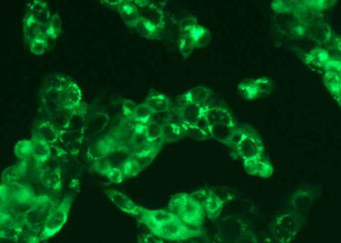 Anti-Human ALB Antibody [B512] - ABMIUM