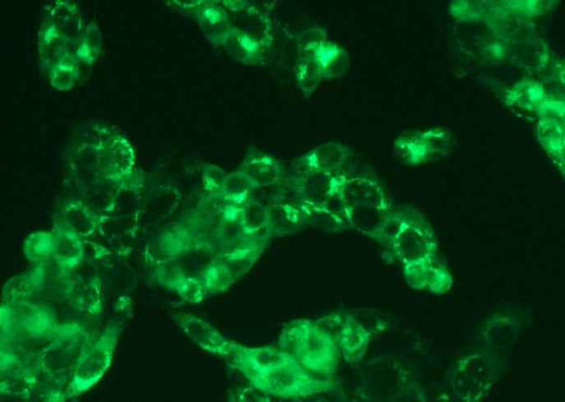 Anti-Human ALB Antibody [B512] - ABMIUM