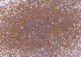 Anti-Human IL6 Antibody [A950] - ABMIUM