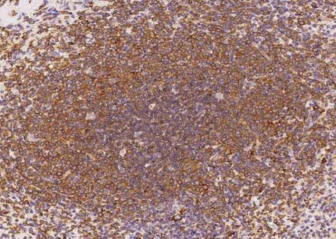 Anti-Human IL6 Antibody [A950] - ABMIUM