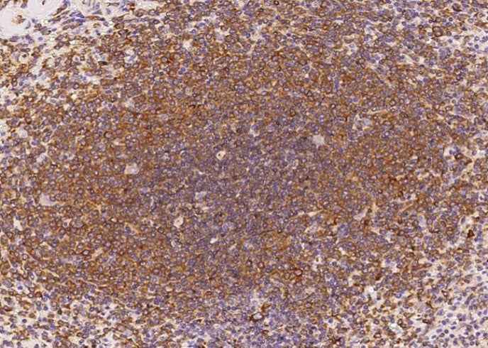 Anti-Human IL6 Antibody [A950] - ABMIUM