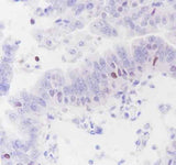 Anti-Human/Rat/Mouse SATB1 Antibody [A356]
