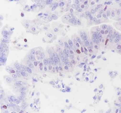 Anti-Human/Rat/Mouse SATB1 Antibody [A356]