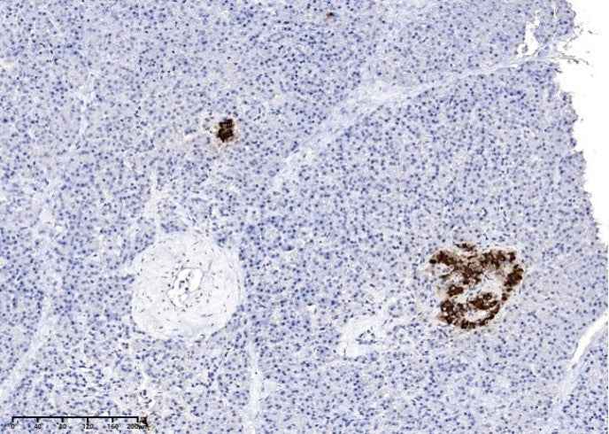 Anti-Human INS Antibody [A1162] - ABMIUM